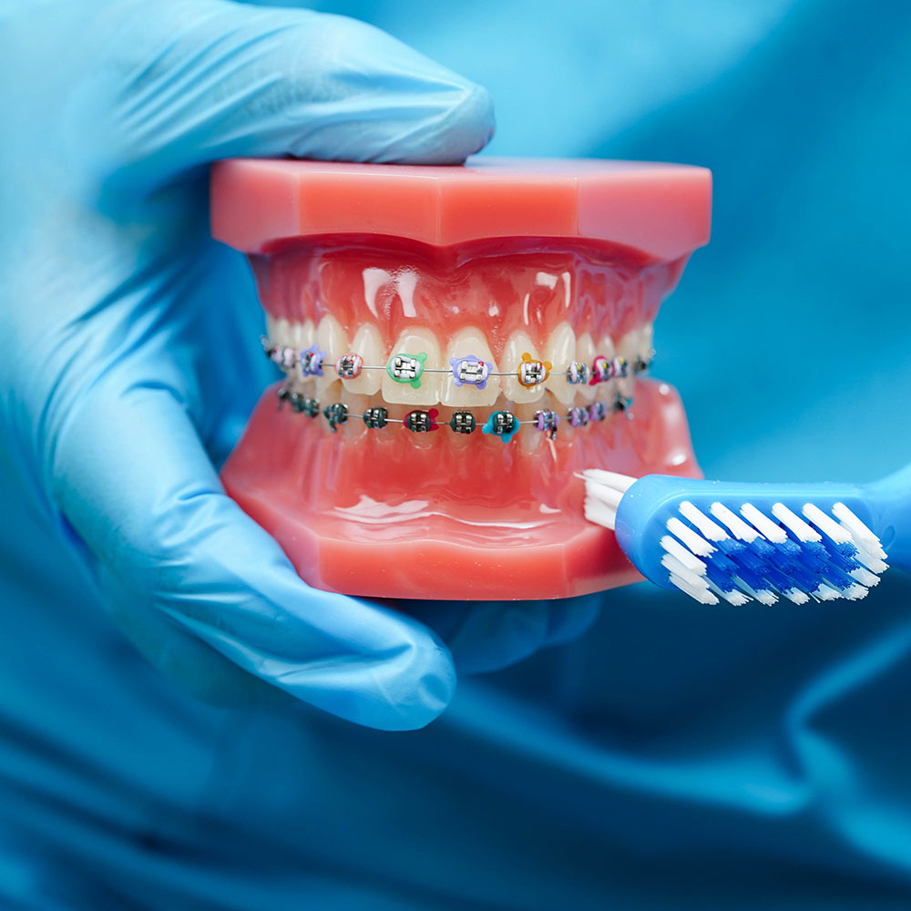 Tratament ortodontic și estetică dentară în Constanța pentru zâmbet corect