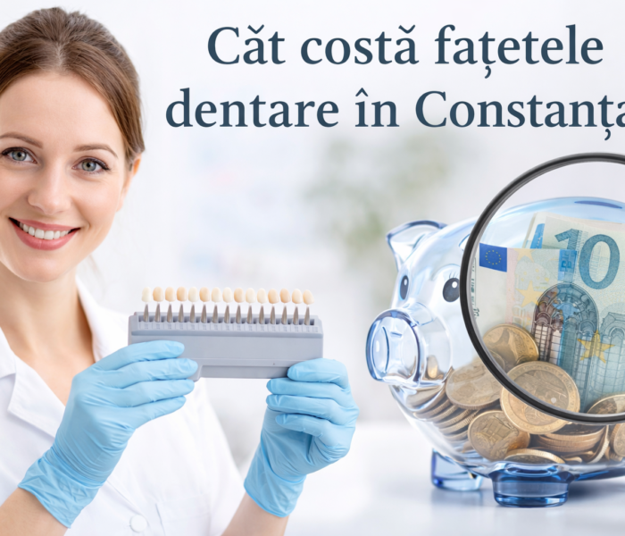 Cât costă fațetele dentare în Constanța