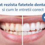 Cât rezistă fațetele dentare și cum le întreții corect