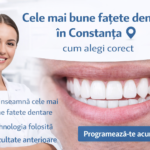 Cele mai bune fațete dentare în Constanța