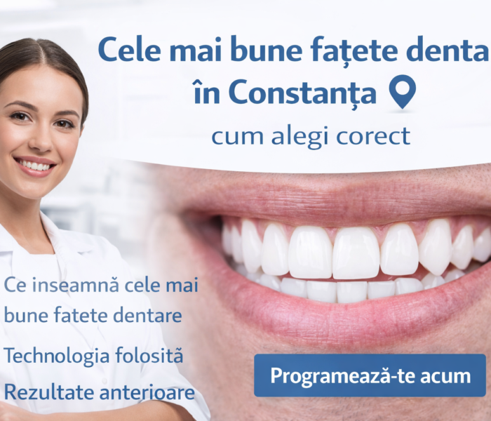 Cele mai bune fațete dentare în Constanța