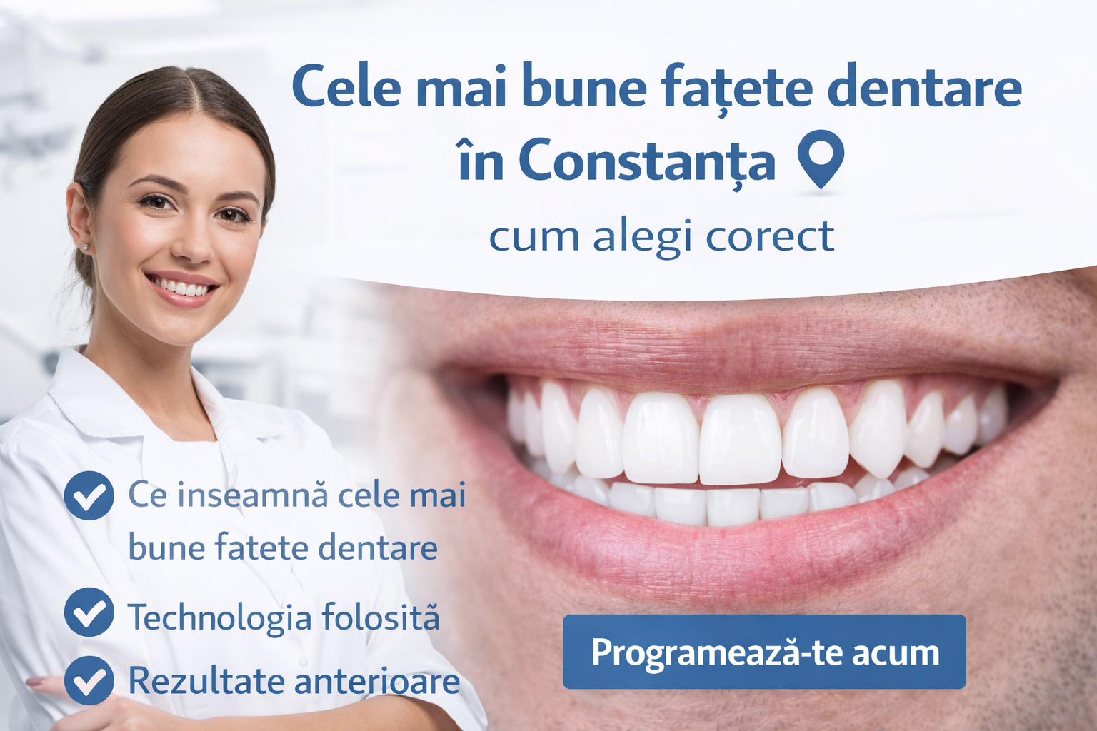 Cele mai bune fațete dentare în Constanța – cum alegi corect