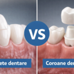 Fațete dentare vs coroane dentare – comparație între tratamente